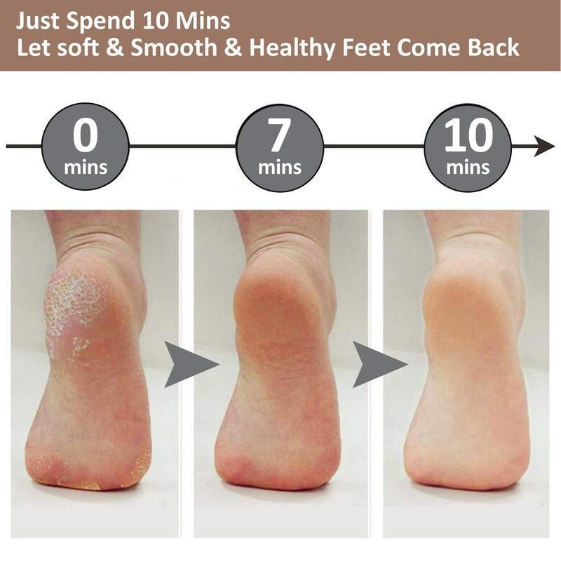 Rechargeable Electric Foot Callus Remover, Cordless Pedicure Machine, Foot Grinder, Portable Foot Files Cleaning Tool for Home and Travel, Winter Gift, Valentine'S Day Gift, Electric Foot File