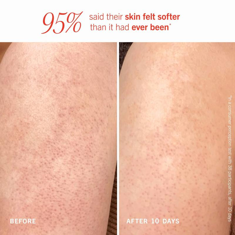 KP Bump Eraser Body Scrub in PEACH | America'S #1 Specialty Body Scrub | Keratosis Pilaris Exfoliator with 10% Ahas (Glycolic and Lactic Acids) to Smooth Skin