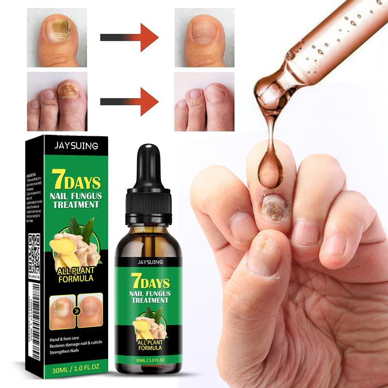 Ginger Nail Care, Nail Growth & Repair for Discolored & Damaged Toenails – Dermatologist-Tested, 1.0 Fl. Oz