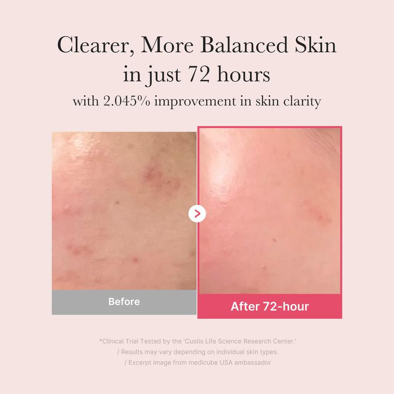 [Medicube Official] TXA Niacinamide 15% Glow Serum | All-In-One Daily Korean Skincare | Uneven Skin Tone, Texture, and Hydration Care